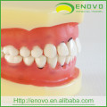 Modèle de dents péridontal dentaire molle démontable EN-L3 pour la formation
